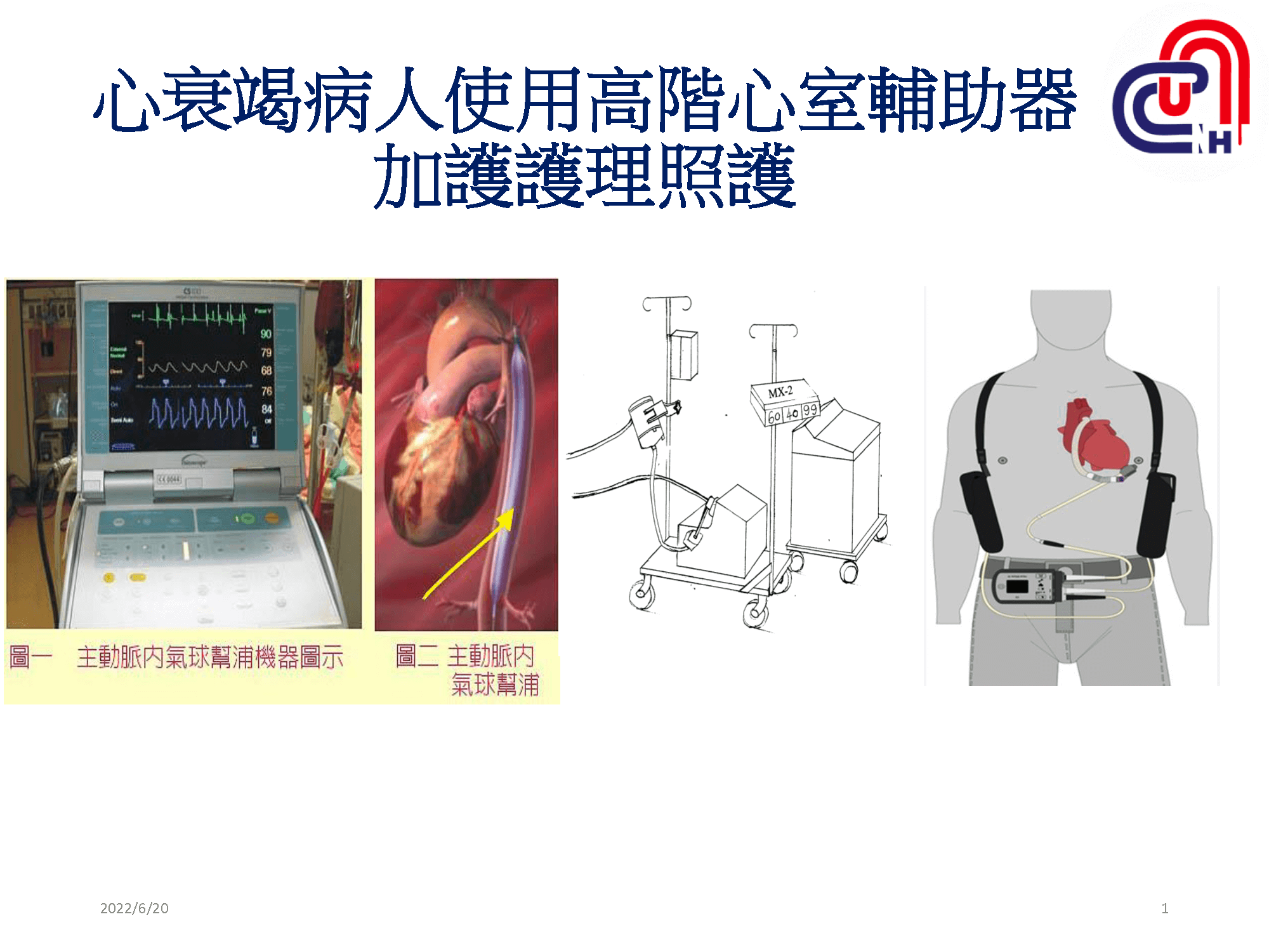心衰病人使用高階device的臨床照護-加護-學術專區_頁面_01