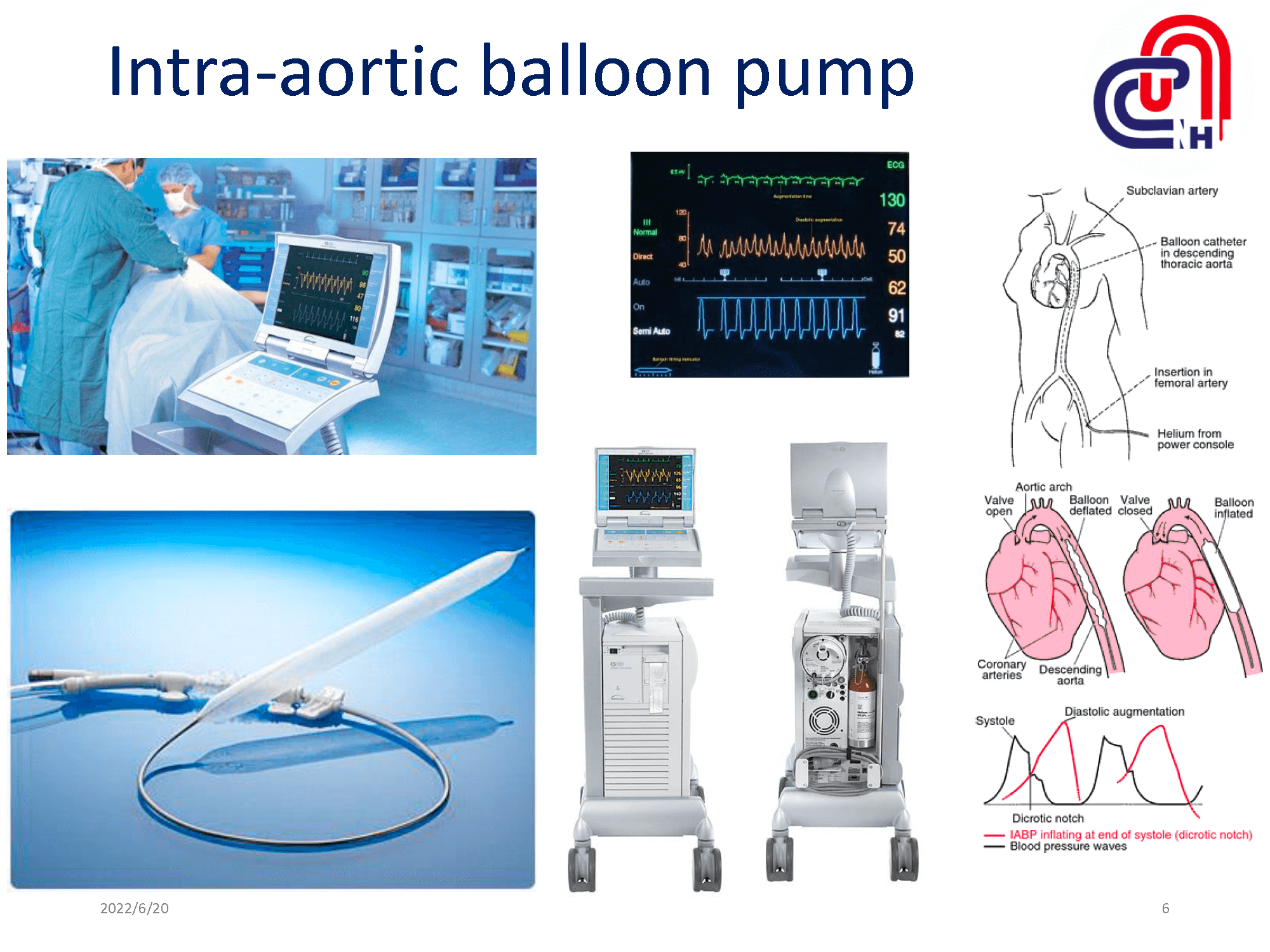 心衰病人使用高階device的臨床照護-加護-學術專區_頁面_06