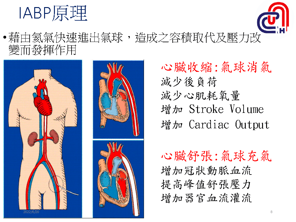 心衰病人使用高階device的臨床照護-加護-學術專區_頁面_08