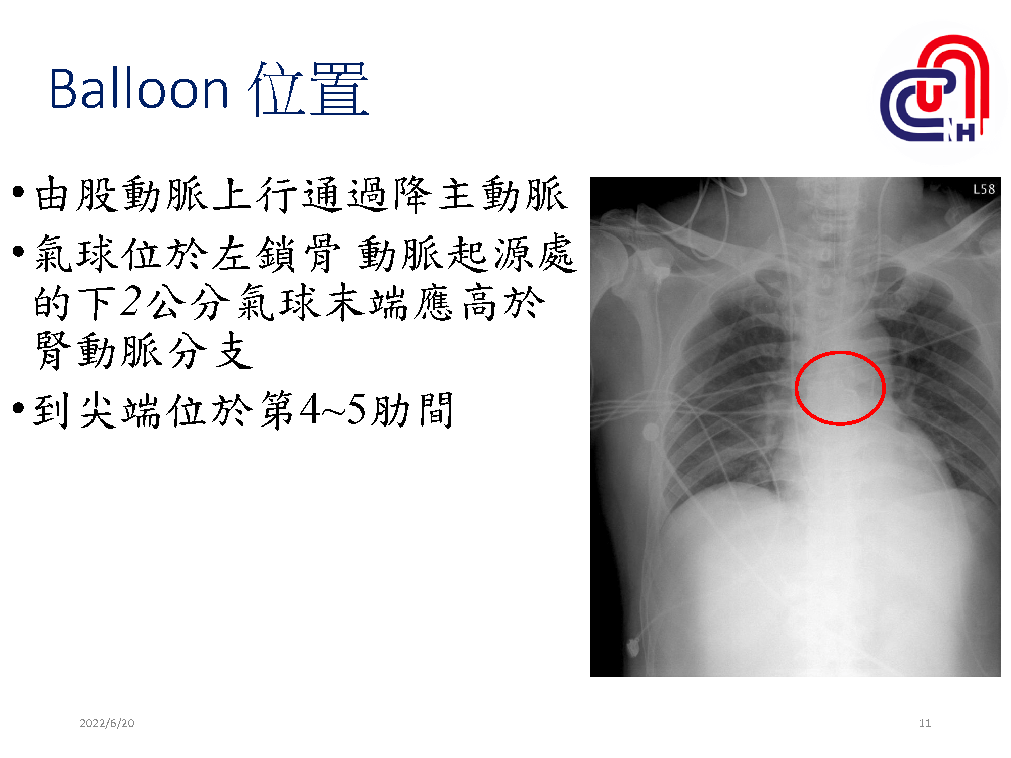 心衰病人使用高階device的臨床照護-加護-學術專區_頁面_11