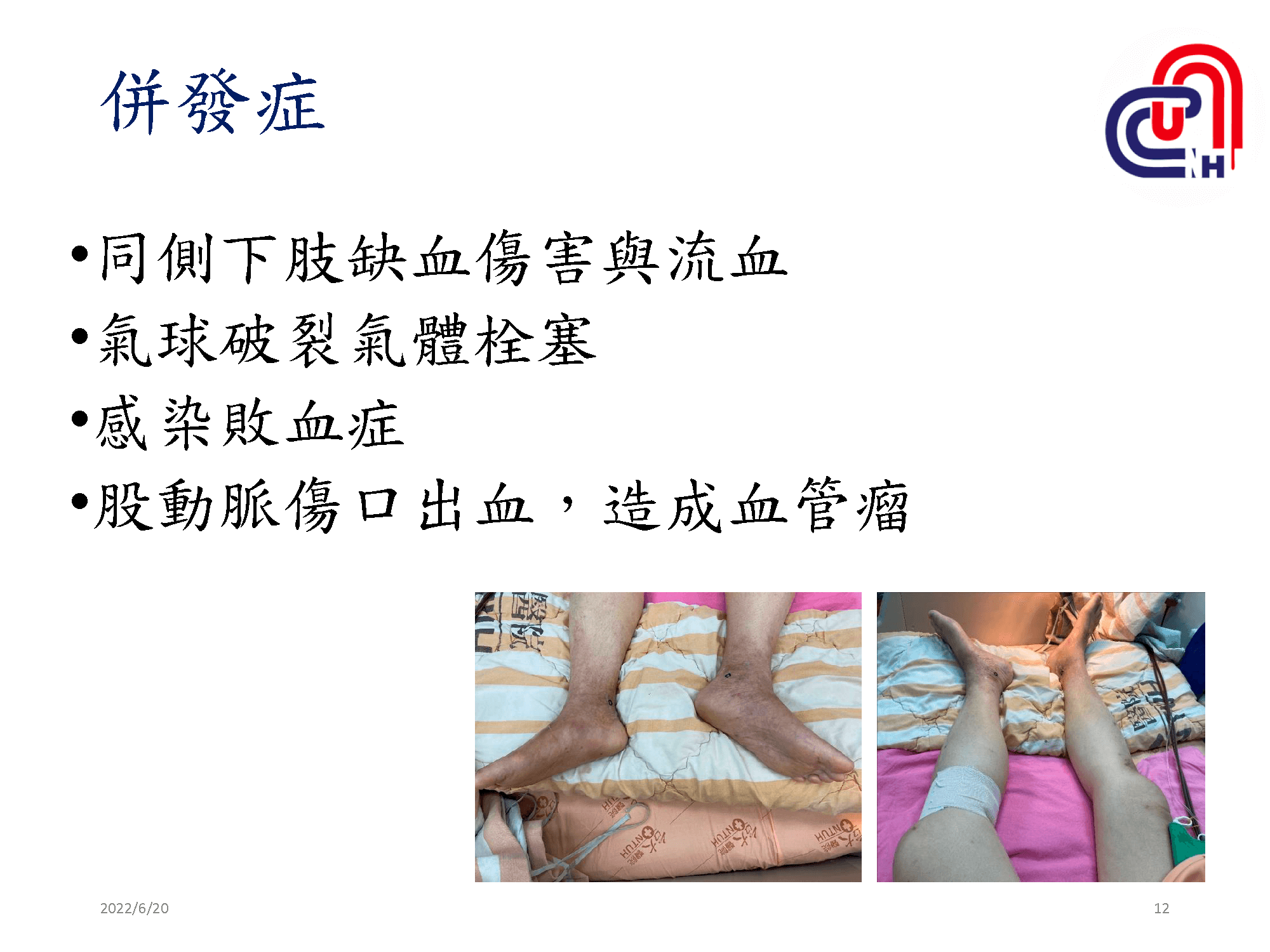 心衰病人使用高階device的臨床照護-加護-學術專區_頁面_12