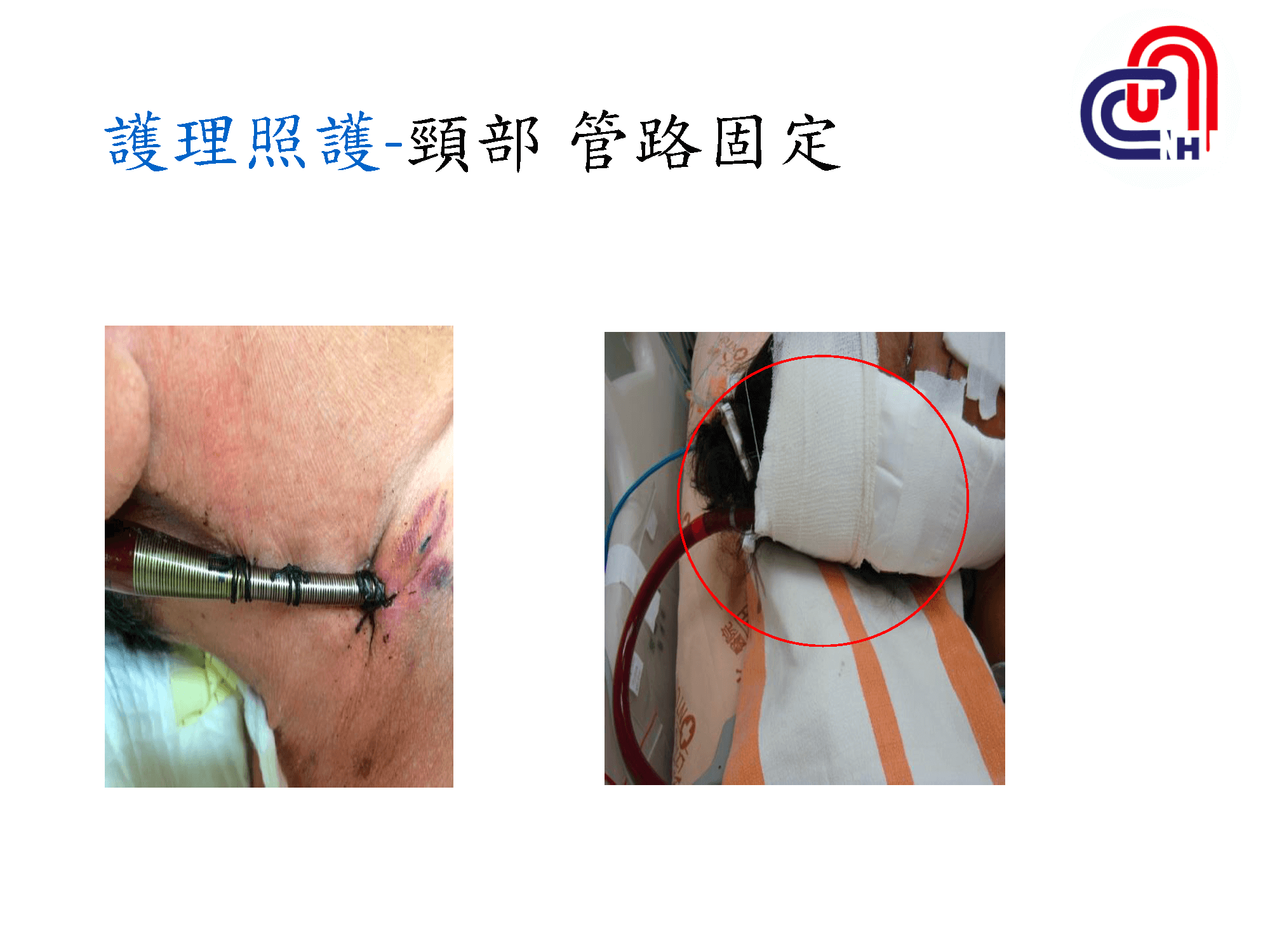 心衰病人使用高階device的臨床照護-加護-學術專區_頁面_22