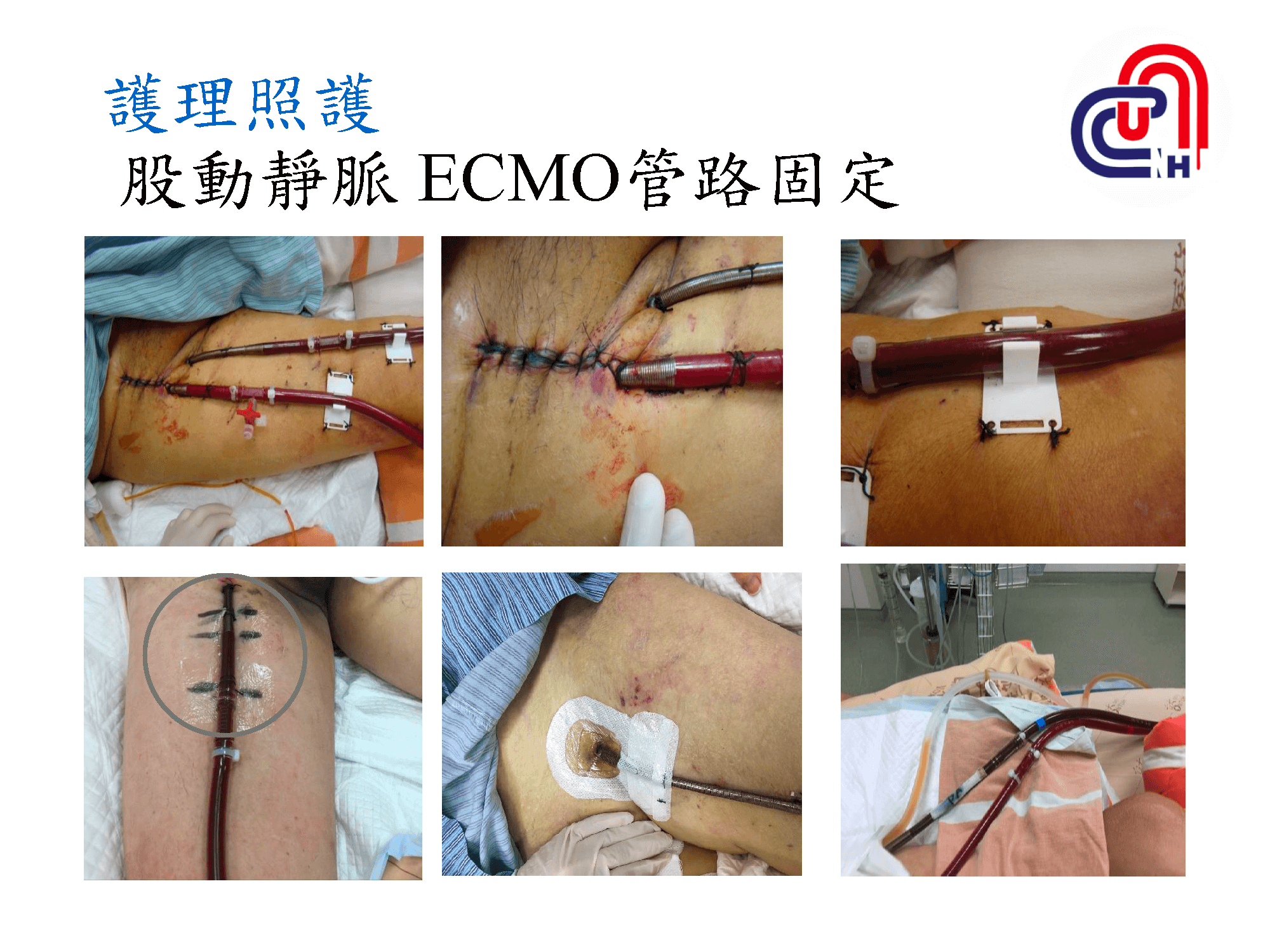 心衰病人使用高階device的臨床照護-加護-學術專區_頁面_23