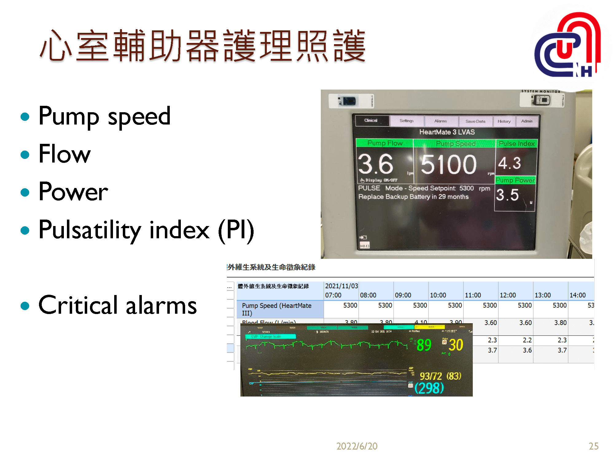 心衰病人使用高階device的臨床照護-加護-學術專區_頁面_25