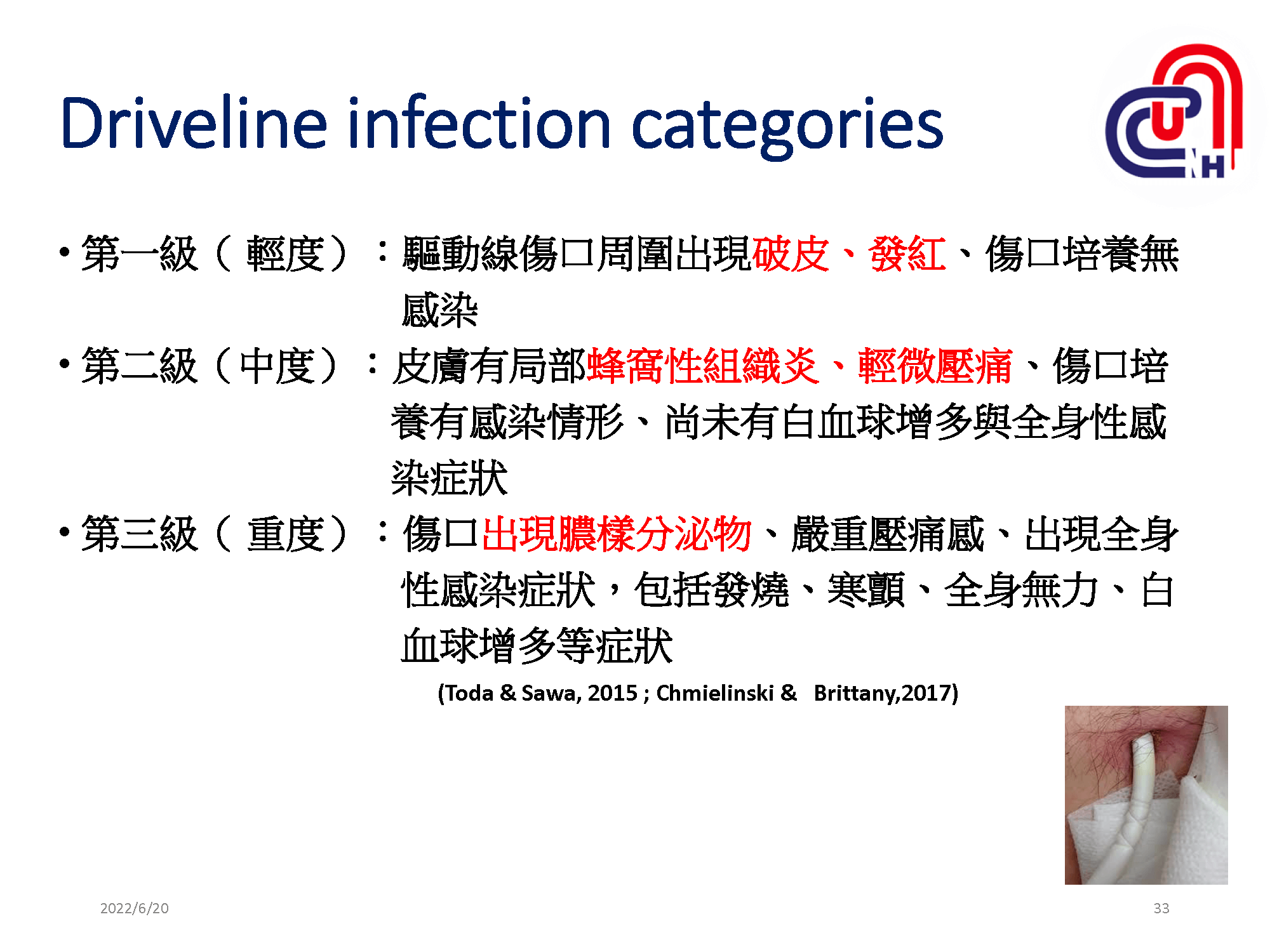 心衰病人使用高階device的臨床照護-加護-學術專區_頁面_33
