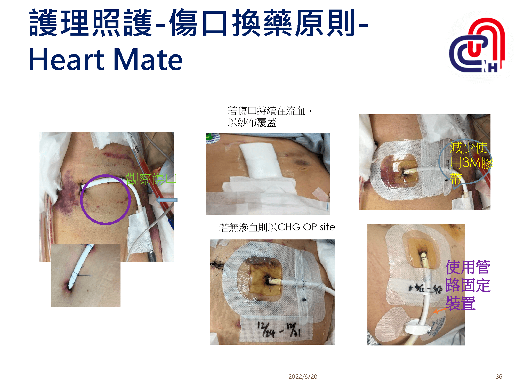 心衰病人使用高階device的臨床照護-加護-學術專區_頁面_36