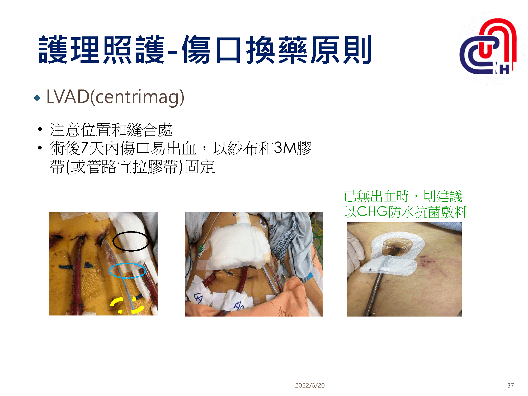 心衰病人使用高階device的臨床照護-加護-學術專區_頁面_37